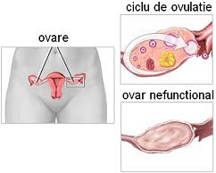 insuficienta ovariana